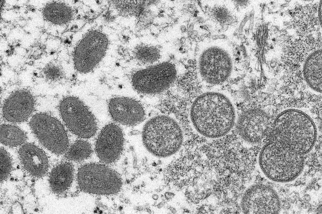 世卫：全球30个非猴痘流行国家和地区已发现超550例猴痘病例