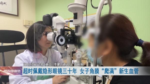 女子戴隐形眼镜30年 双眼角膜长满血管
