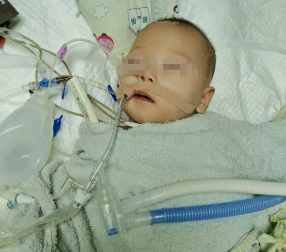 仅16斤女婴肚子暗藏5斤多重肿瘤，福州医生创下生命奇迹