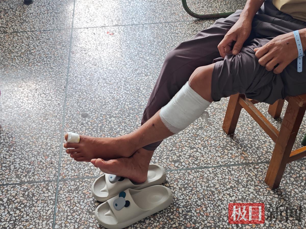 缅北4岁半男童被炮弹炸伤来中国治疗