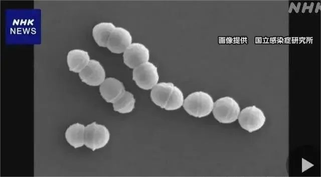 容易被误诊为感冒，日本“食人菌”感染破千！发病到休克最快只需24小时