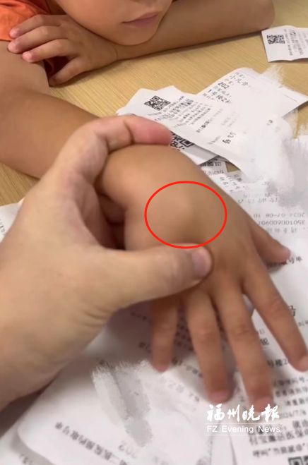 男孩拍“烟卡” 拍出“鼠标手”