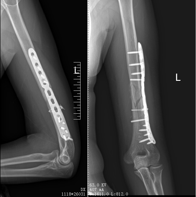 咔嚓一声，胳膊断了！这种游戏别太“上头”……