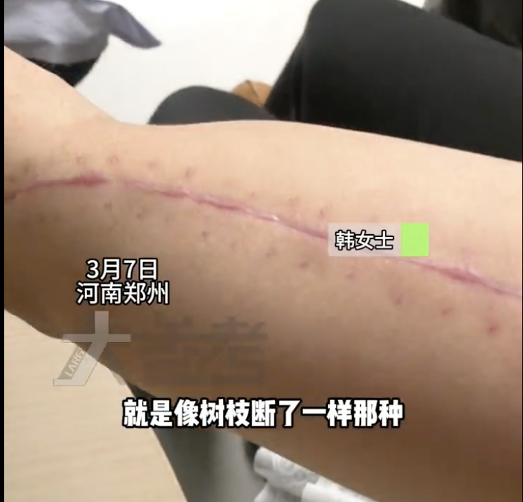 咔嚓一声，胳膊断了！这种游戏别太“上头”……