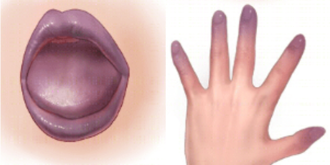 以为能吃，其实可能“有毒”的7种食物！一定要扔！