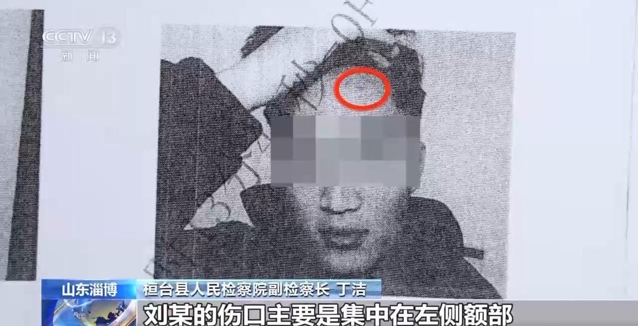 被打后还手属于正当防卫还是互殴