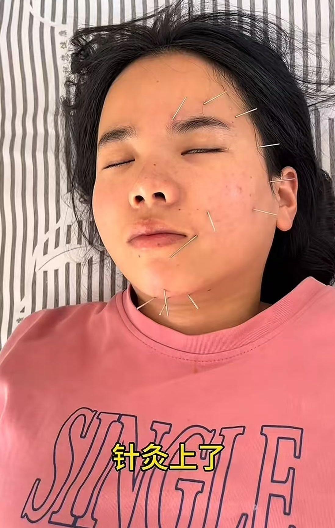 女子午休时开风扇 睡醒后面瘫