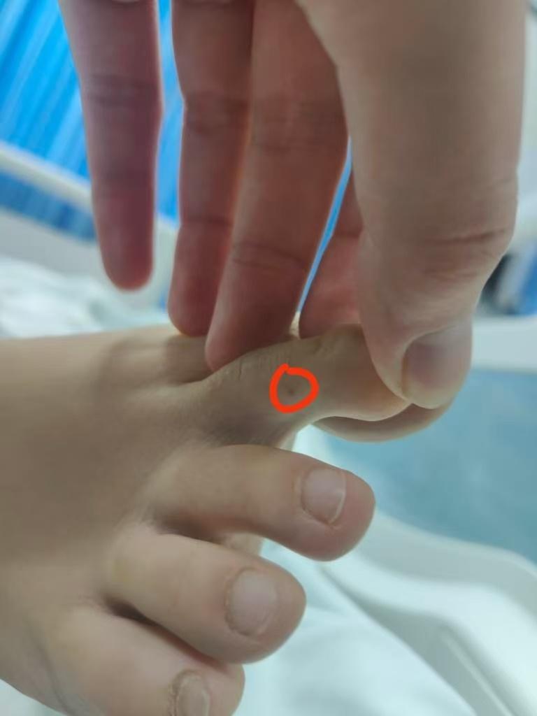 被咬身亡女子亲戚：遗体还在病房