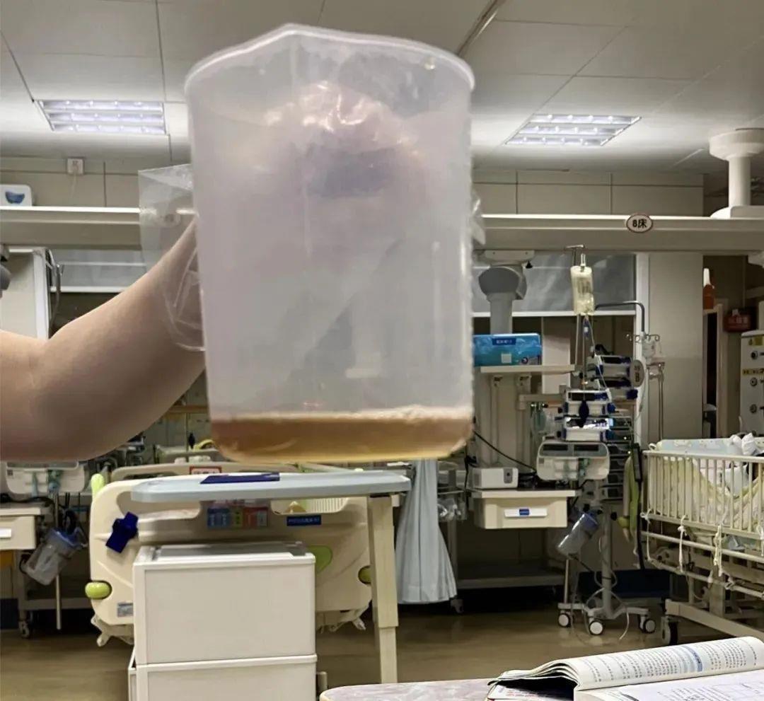 广东5岁男孩吃1包坚果住进ICU 只因含有“它”