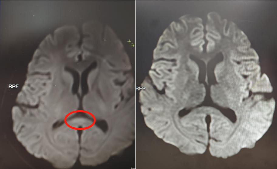 30岁女子突然性情大变！非要在屋里撑红伞，家人崩溃……
