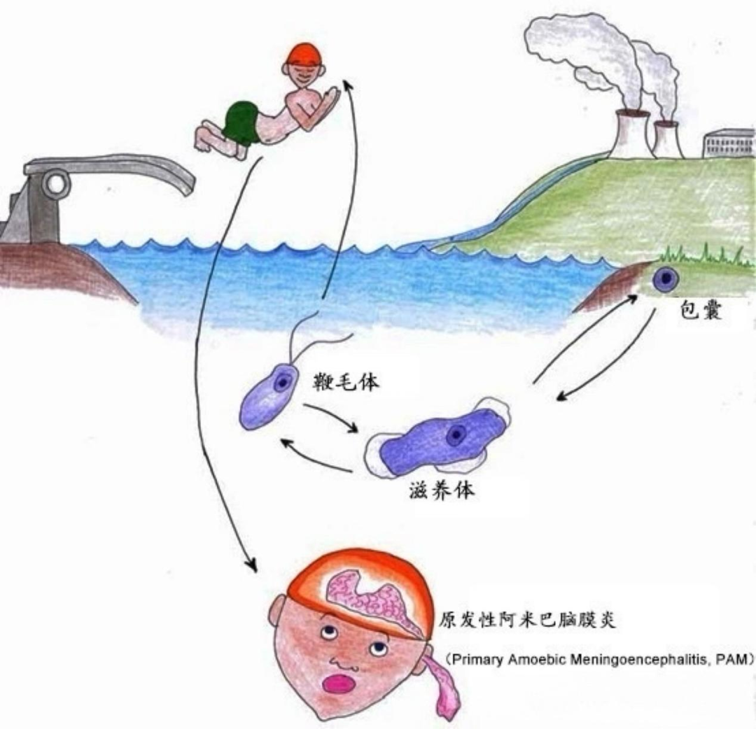 家长注意！儿童玩水后感染“食脑虫”，专家提醒