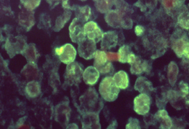 家长注意！儿童玩水后感染“食脑虫”，专家提醒