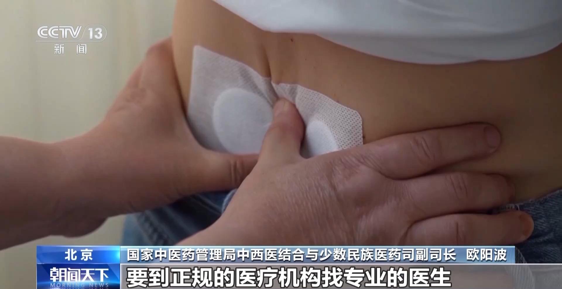 “三伏贴”究竟应该怎么贴？国家中医药管理局特别提醒→