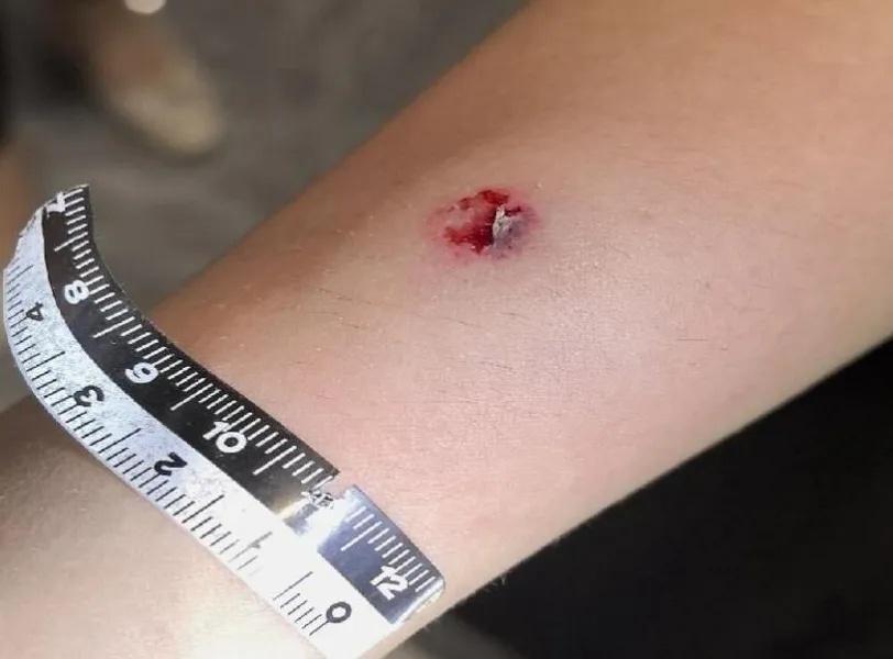 司机等红灯向路人射钢珠致4人受伤