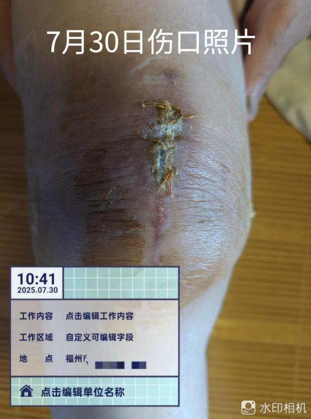 解决群众急难愁盼 | 仓山区 “家门口” 的医疗守护