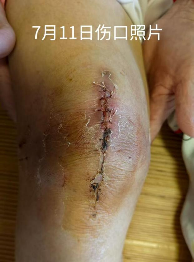 解决群众急难愁盼 | 仓山区 “家门口” 的医疗守护