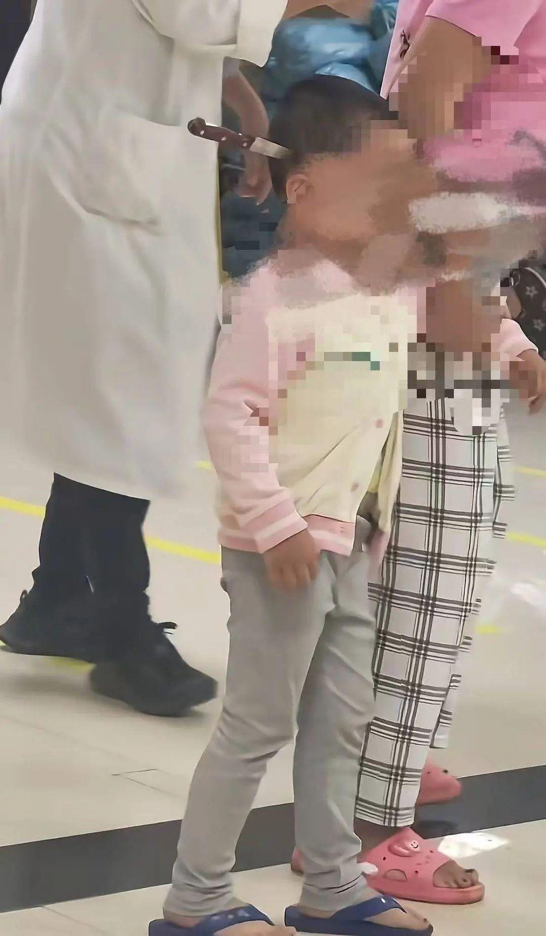 云南3岁女童头上插刀淡定就医，受伤原因公布
