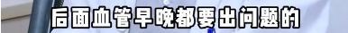 45岁三甲医院脑梗专家自己脑梗了