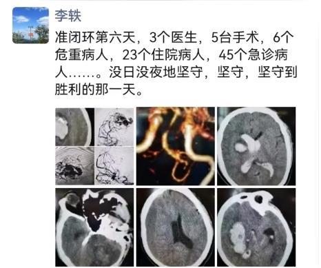 45岁三甲医院脑梗专家自己脑梗了