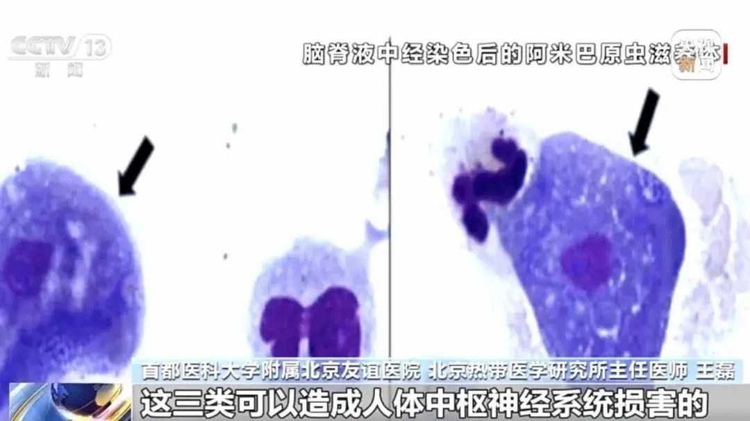 1个月2名儿童相继离世！没有特效药，玩水一定注意这5点→