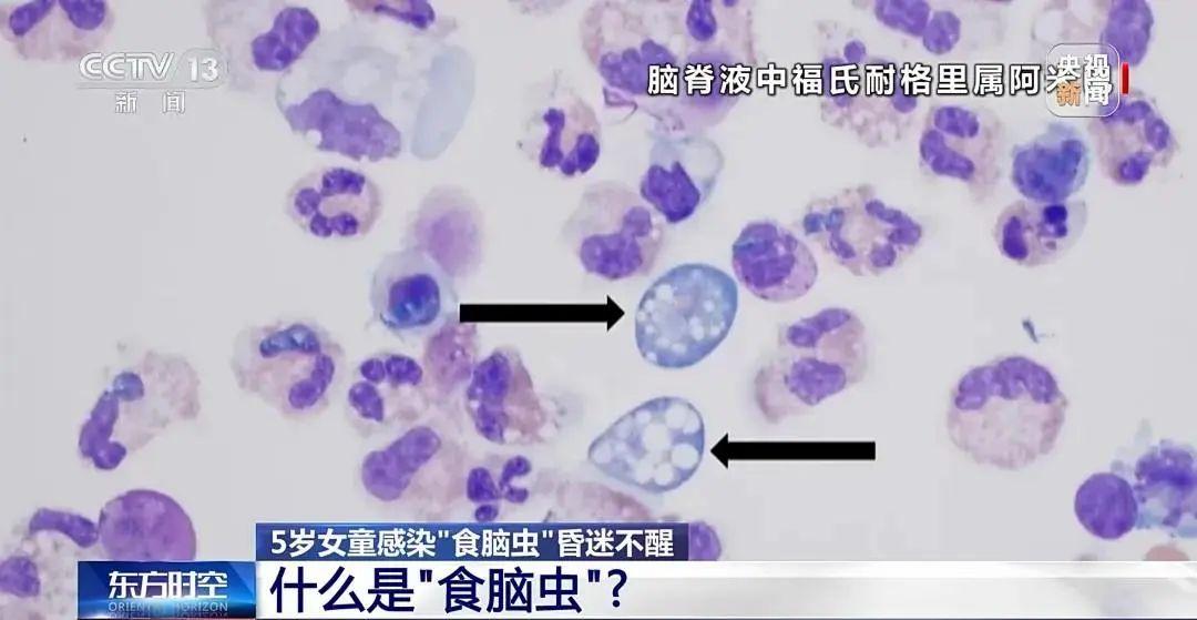 1个月2名儿童相继离世！没有特效药，玩水一定注意这5点→