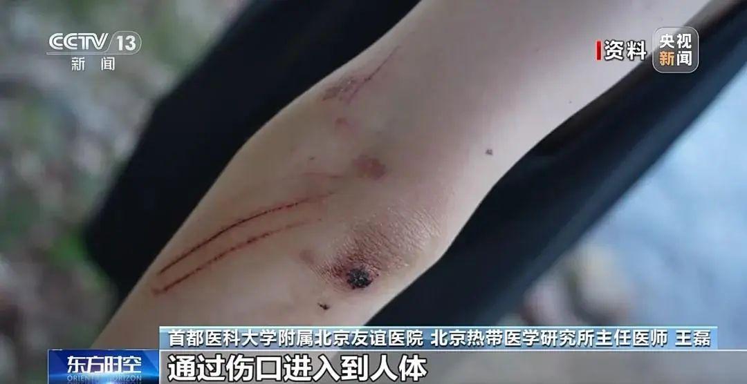 1个月2名儿童相继离世！没有特效药，玩水一定注意这5点→