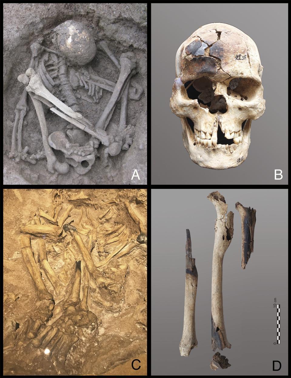 东南亚惊现1.2万年前木乃伊 或是世界上已知最古老木乃伊