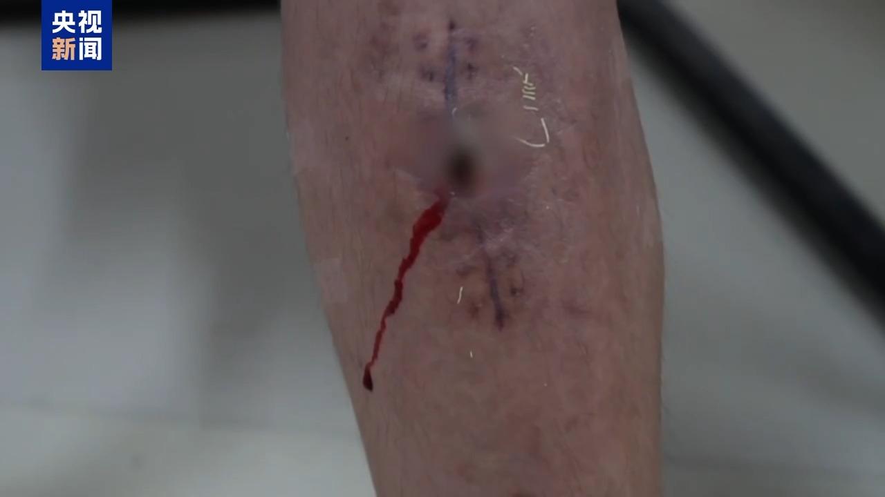 武装力量有编制、接班人杀人祭天 缅北果敢魏家犯罪集团专案细节曝光