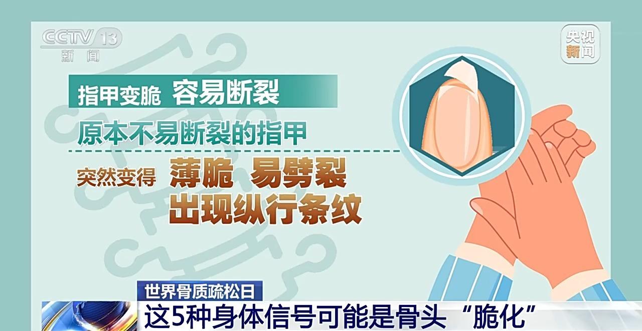 你的骨头还结实吗？5道题自测骨质疏松风险 答中一个就要当心