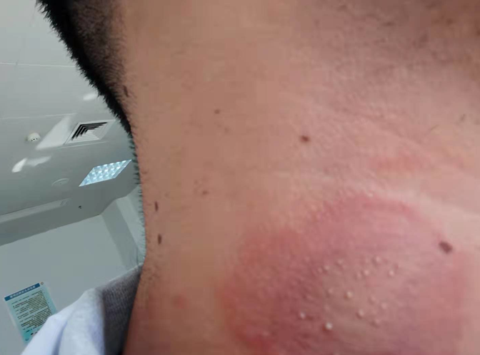 重要提醒！最近少穿黄色、绿色衣服出门！