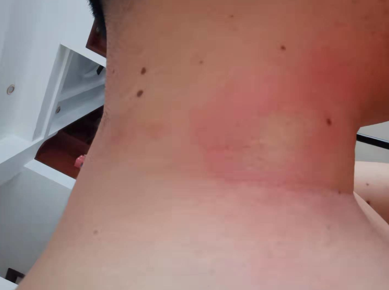 重要提醒！最近少穿黄色、绿色衣服出门！